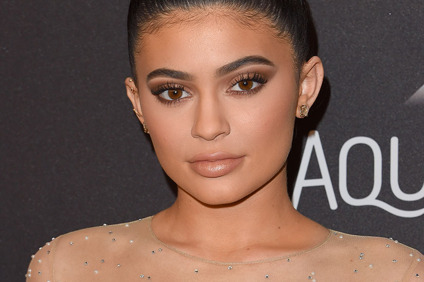 kylie-jenner-injections-levres